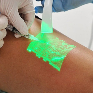 静脈可視化装置